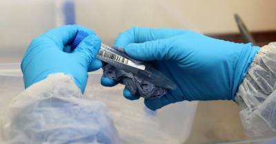 Christmas Eve - Britain's biggest coronavirus testing lab hit by Covid-19 outbreak - dailystar.co.uk - Britain