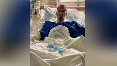 Father severely burned, hospitalized after saving kids from house fire - fox29.com