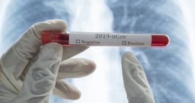 Two new coronavirus cases confirmed in Simcoe Muskoka, local total at 513 - globalnews.ca