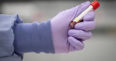 Nova Scotia - Nova Scotia confirms 1 new case of coronavirus Saturday - globalnews.ca - county Halifax