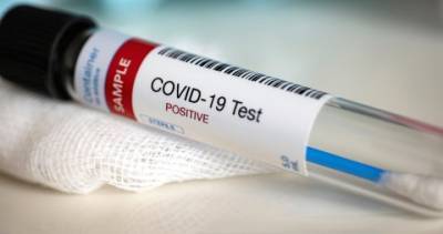 Coronavirus: Manitoba sees one new case Sunday - globalnews.ca
