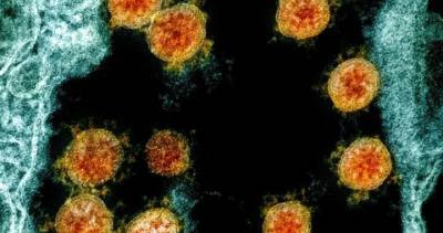 Canada reports 29 more coronavirus deaths as cases top 99,000 - globalnews.ca - Canada - county Ontario