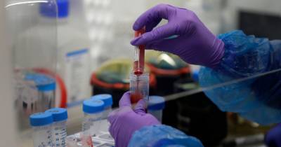 'Major breakthrough' as drug trial finds steroid can reduce coronavirus deaths - manchestereveningnews.co.uk