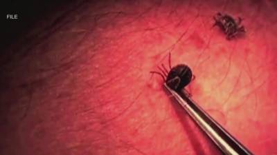 Some symptoms of Lyme disease are similar to COVID-19, health officials say - fox29.com