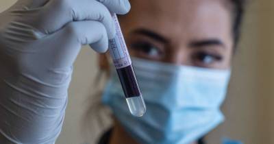 Blood test that can spot 98% of virus cases a 'game-changer' for identifying immunity - mirror.co.uk - Britain - city Birmingham