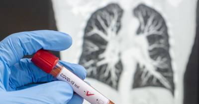 One in three coronavirus survivors 'may suffer permanent damage to lungs' - mirror.co.uk - Britain