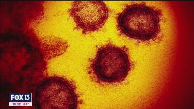 Study uncovers link between blood type and coronavirus susceptibility - fox29.com - Italy - Spain - state Florida