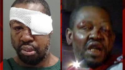 Markeith Loyd - Orlando officers acted ‘reasonably’ when they beat accused cop killer Markeith Loyd, report says - clickorlando.com
