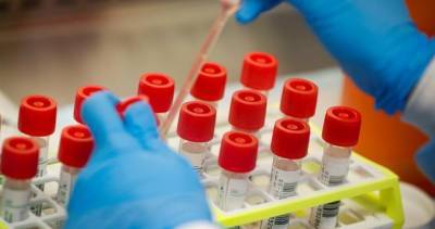 Saskatchewan reports 6 new coronavirus cases as single-day testing soars above 1,000 - globalnews.ca - province Saskatchewan