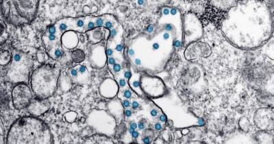 Waterloo Region sees first coronavirus death in weeks - globalnews.ca - city Waterloo - county Windsor - county Essex
