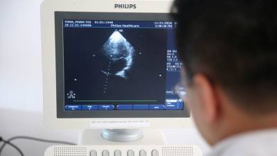 More than half of COVID-19 patients scanned in study show heart abnormalities, researchers say - fox29.com