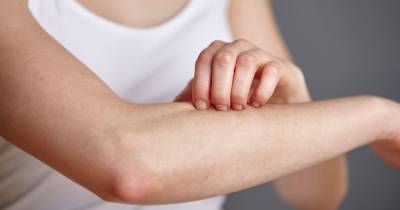 Skin rashes and blotches could be coronavirus symptoms, study says - dailystar.co.uk