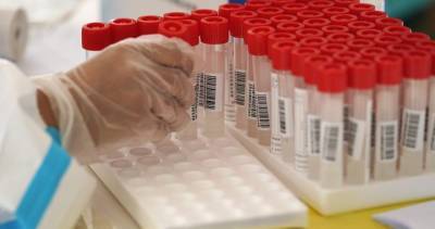 1 new coronavirus case announced by Waterloo Public Health - globalnews.ca - city Waterloo