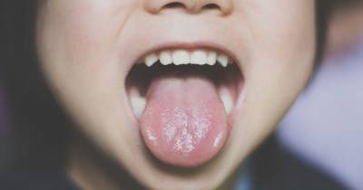 What your tongue really says about your health – and signs to look out for - dailystar.co.uk