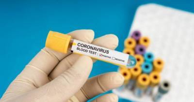 Hiawatha I (I) - Lake I (I) - Peterborough Public Health - Coronavirus: No new cases for Peterborough area for 32nd consecutive day - globalnews.ca - county Centre - city Peterborough, county Peterborough - county Peterborough