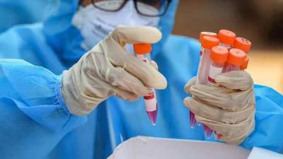 Singapore scientists develop coronavirus test technique that delivers results in 36 minutes - livemint.com - Singapore - city Singapore