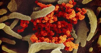 Manitoba reports 3 new coronavirus cases Wednesday, hospitalizations up - globalnews.ca