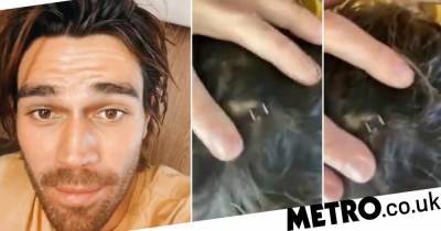 KJ Apa splits his head open filming pandemic movie and could not be more casual about it - metro.co.uk