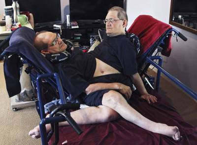 World's longest-surviving conjoined twin brothers die at 68 - clickorlando.com - state Ohio - city Dayton, state Ohio