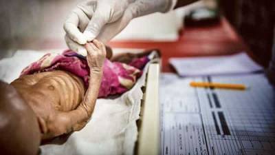 Pandemic will increase India's malnutrition burden, says Unicef - livemint.com - city New Delhi - India