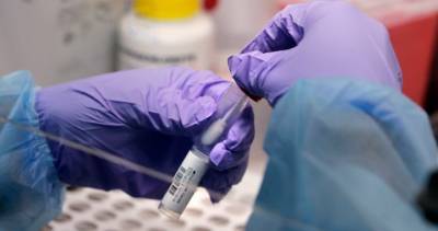 Ontario reports 95 new coronavirus cases, 1 death; total cases at 40,289 - globalnews.ca