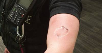 Ian Hopkins - Thug who bit police officer during height of coronavirus lockdown is jailed - manchestereveningnews.co.uk - city Manchester - city Rochdale