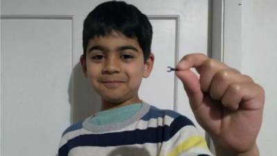 Lego piece dislodged from kid’s nose after two years: report - fox29.com - New Zealand