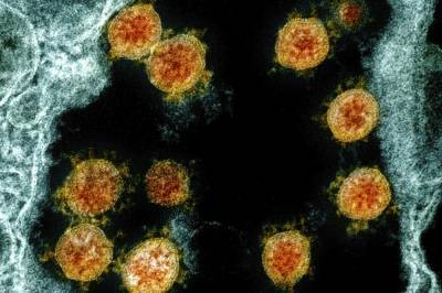 Scientists say man got coronavirus a second time - clickorlando.com - Spain - Hong Kong - city Hong Kong