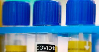Nova Scotia - Nova Scotia reports no new cases of COVID-19 on Tuesday - globalnews.ca