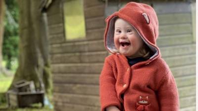Girl, 2, with Down syndrome stars in fashion campaign - fox29.com