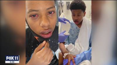 Lakewood boy, 16, shares his story after difficult battle with COVID-19 following birthday party - fox29.com - city Lakewood