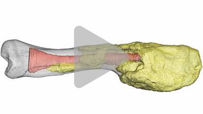Doctors diagnose advanced cancer—in a dinosaur - sciencemag.org - Canada - county Park