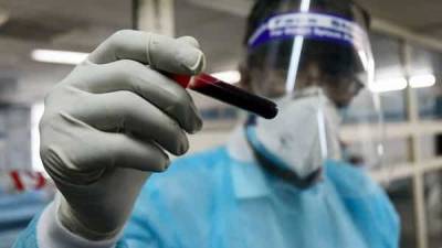 Blood test may point to patients at higher risk for Covid-19 death - livemint.com - China - Usa