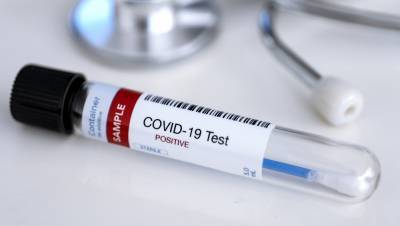 217 more cases of Covid-19 confirmed, no further deaths - rte.ie - county Republic - Ireland