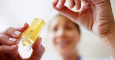 Doctors develop urine test that can tell you if your diet is healthy in five minutes - mirror.co.uk - Usa - state Illinois - Australia - city London