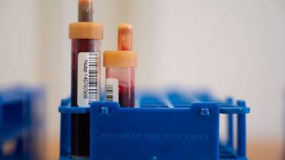 Eli Lilly - Study: Antibody drug may reduce COVID-19 hospitalizations - fox29.com - Los Angeles