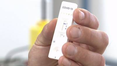 New test for COVID-19 costs just $20, gets results in 10 minutes - fox29.com - city Milwaukee