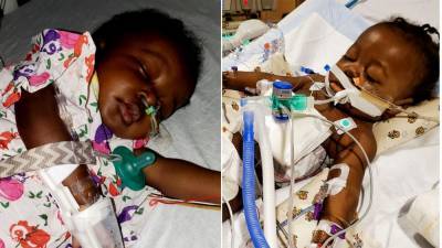 NY baby survives coronavirus, liver transplant - fox29.com - New York - city New York - city Syracuse