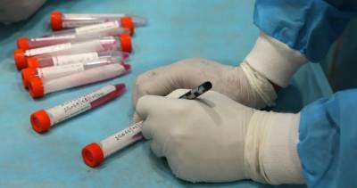 72 new coronavirus cases, 1 additional death confirmed in Simcoe Muskoka - globalnews.ca