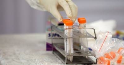 Christine Elliott - Ontario reports 1,913 new coronavirus cases, 46 more deaths - globalnews.ca - county York