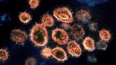 Scientists decode how coronavirus damages lung cells within hours - livemint.com - Usa - city Boston