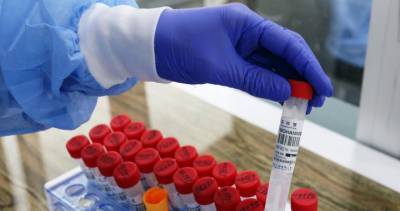 70 new coronavirus cases, one additional death reported in Simcoe Muskoka - globalnews.ca - county Midland
