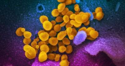 Coronavirus: Hamilton tops 7,000 cases amid COVID-19 pandemic - globalnews.ca