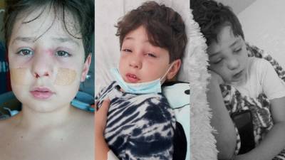Casa Grande little boy battles serious sinus cavity infection after COVID-19 diagnosis - fox29.com