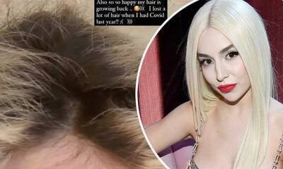 Ava Max - Ava Max says her 'hair is growing back' after dealing with hair loss after COVID-19 battle in 2020 - dailymail.co.uk - Usa