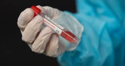 Coronavirus: 1 death, 24 new cases in London-Middlesex; 1 death, 17 cases in Lambton - globalnews.ca - city London