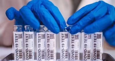 Coronavirus: 144 new COVID-19 cases, 2 additional deaths confirmed in Simcoe Muskoka - globalnews.ca