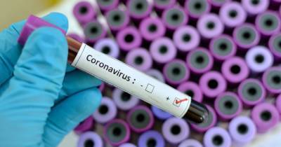 Danny Altmann - People infected with coronavirus 'could still catch Brazil variant', expert warns - dailyrecord.co.uk - Britain - Scotland - Brazil
