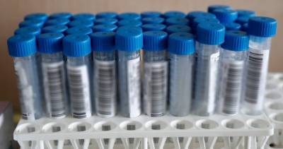 Coronavirus: 45 new COVID-19, 33 variant cases, 1 additional death confirmed in Simcoe Muskoka - globalnews.ca - Canada - county Simcoe - county Bradford