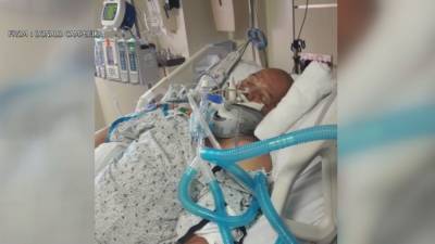 Cyclist who suffered traumatic brain injury in hit-and-run still on road to recovery - fox29.com